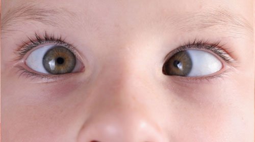 Oftalmopediatria